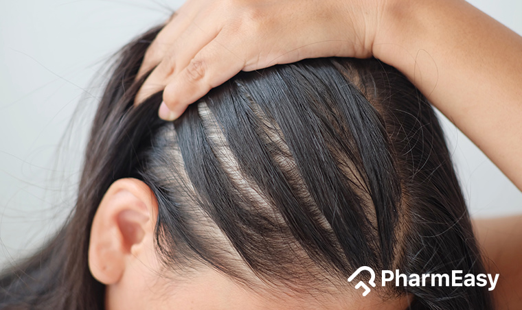 home remedies for hair thinning