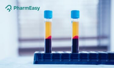 normal platelet count