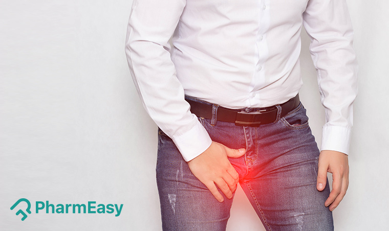 Varicocele - Home Remedies