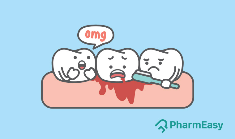 home remedies for bleeding gums