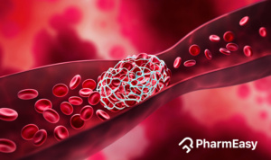 blood clot treatment at home