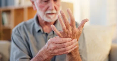 arthritis